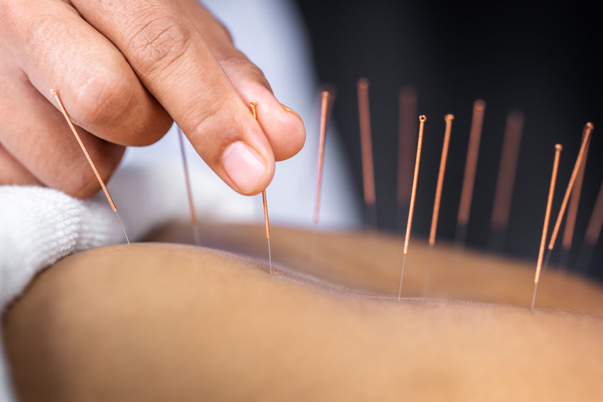 Application d'aiguilles d'acupuncture pendant un traitement