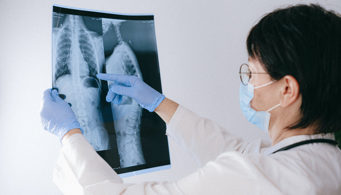 Radiographie examinée par un clinicien